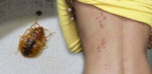 Servicios de control de plagas - MIPU